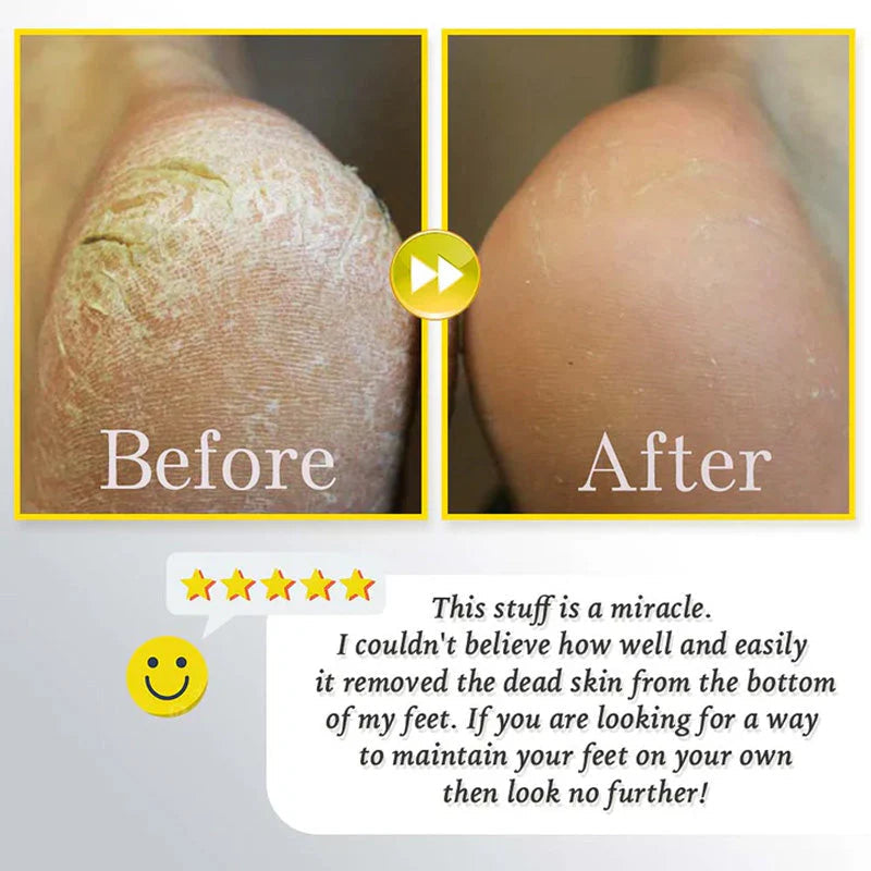đ„HOT SALE 49% OFFđ„Rechargeable Electric Foot Exfoliating Scrubber