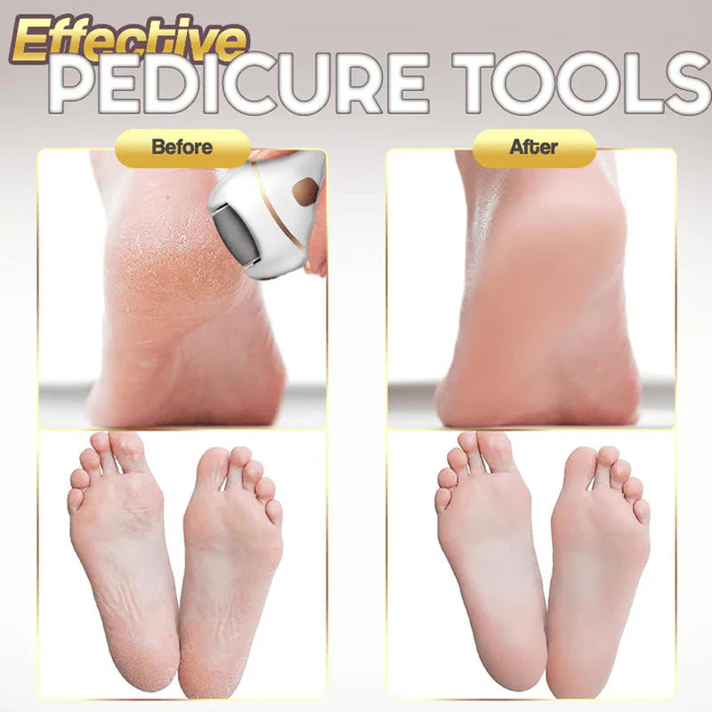 đ„HOT SALE 49% OFFđ„Rechargeable Electric Foot Exfoliating Scrubber